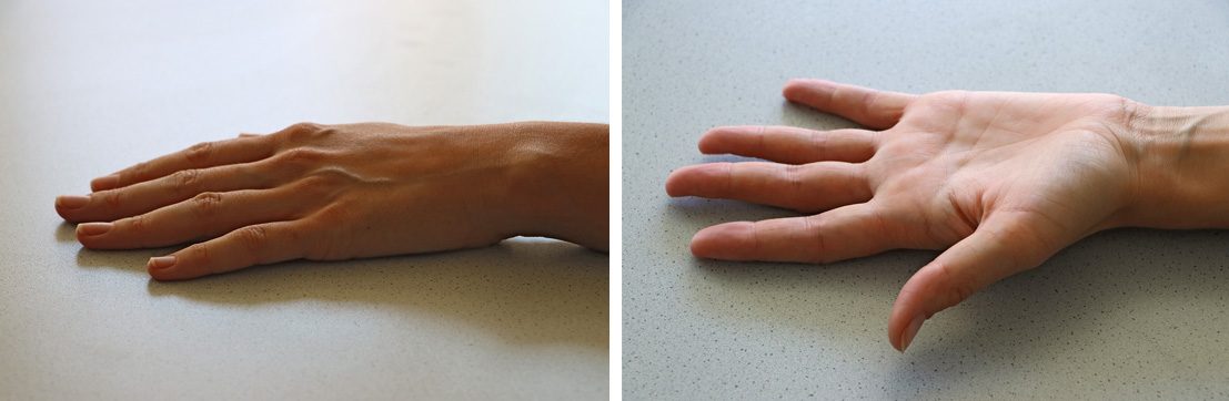 Abb.: Richtig – kein Schmuck oder Nagellack, Fingernägel schließen mit der Fingerkuppe ab